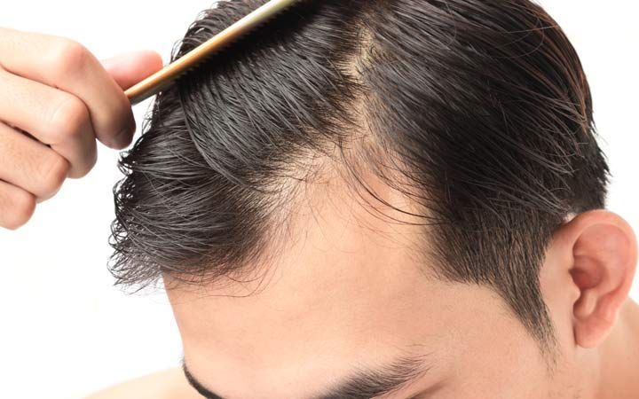 Does Nicotine Cause Hair Loss Understanding the Link